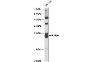 Western blot analysis of extracts of SW620 cells, using FGF19 antibody (ABIN6127925, ABIN6140595, ABIN6140596 and ABIN6222270) at 1:1000 dilution.