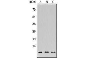 anti-Family with Sequence Similarity 215, Member A (Non-Protein Coding) (FAM215A) (C-Term) antibody