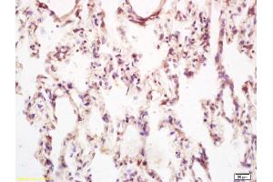 Formalin-fixed and paraffin embedded rat lung tissue labeled with Anti-PPIG Polyclonal Antibody, Unconjugated (ABIN700450) at 1:200, followed by conjugation to the secondary antibody and DAB staining (PPIG antibody  (AA 351-450))