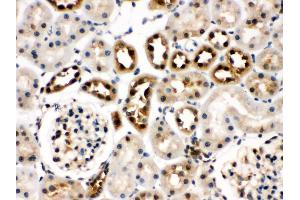 Immunohistochemistry (Paraffin-embedded Sections) (IHC (p)) image for anti-Heat Shock 70kDa Protein 8 (HSPA8) (AA 520-614) antibody (ABIN3043852) (Hsc70 antibody  (AA 520-614))