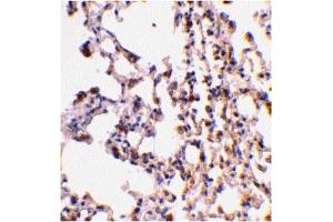 Immunohistochemistry (IHC) image for anti-BH3 Interacting Domain Death Agonist (BID) (C-Term) antibody (ABIN1030296)