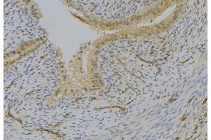 ABIN6276932 at 1/100 staining Human uterus tissue by IHC-P. (LY96 antibody  (Internal Region))