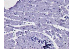 ABIN184728 Negative Control showing staining of paraffin embedded Human Bone Marrow, with no primary antibody. (KLF1 antibody  (N-Term))