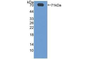 Detection of Recombinant SGSH, Human using Polyclonal Antibody to N-Sulfoglucosamine Sulfohydrolase (SGSH) (SGSH antibody  (AA 21-389))