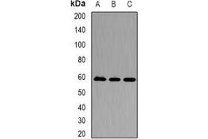 Western blot analysis of Karyopherin alpha-3 expression in Jurkat (A), A549 (B), Hela (C) whole cell lysates. (KPNA3 antibody)