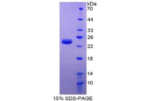 SDS-PAGE (SDS) image for Parkinson Protein 7 (PARK7) (AA 1-189) protein (His tag) (ABIN1080468) (PARK7/DJ1 Protein (AA 1-189) (His tag))
