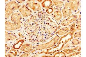 IHC image of ABIN7159229 diluted at 1:200 and staining in paraffin-embedded human kidney tissue performed on a Leica BondTM system. (Melanoma gp100 antibody  (AA 25-467))