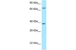 Western Blotting (WB) image for anti-Thymocyte Selection Associated (THEMIS) (C-Term) antibody (ABIN2789620)