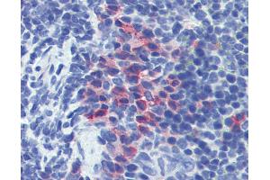 Anti-CD11b antibody IHC of mouse spleen.