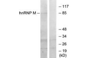 Western blot analysis of extracts from HT-29 cells, using hnRNP M Antibody. (HNRNPM antibody  (AA 11-60))