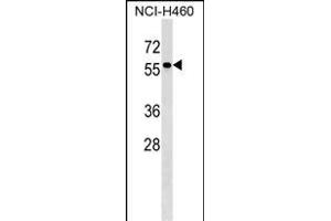 TYRP1 Antibody (Center) (ABIN1538332 and ABIN2849139) western blot analysis in NCI- cell line lysates (35 μg/lane). (Tyrosinase-Related Protein 1 antibody  (AA 341-371))