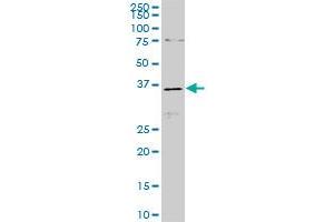 CDX4 monoclonal antibody (M06), clone 3F3. (CDX4 antibody  (AA 71-170))