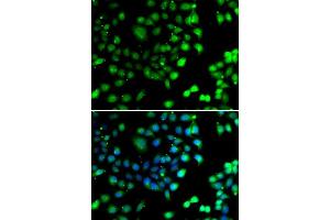 Immunofluorescence analysis of A549 cells using NTMT1 antibody (ABIN5974268). (METTL11A antibody)