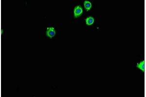 RPL26 Antikörper  (AA 48-143)