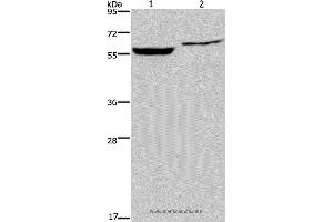 Western blot analysis of Raji and 293T cell, using IMPDH1 Polyclonal Antibody at dilution of 1:500 (IMPDH1 antibody)