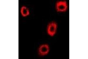 Immunofluorescent analysis of p102 staining in U2OS cells. (COPB2 antibody)