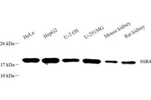 Western blot analysis of SSR4 (ABIN7075599) at dilution of 1: 800 (SSR4 antibody)