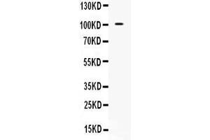 Western blot analysis of NARG1 expression in 293T whole cell lysates ( Lane 1). (NAA15 antibody  (N-Term))