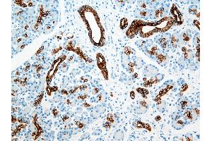 Immunohistochemistry (IHC) image for anti-Keratin 8/18/19 (KRT8/18/19) antibody (ABIN108431) (Keratin 8/18/19 antibody)