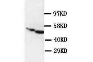 Polyclonal Anti-Glial fibrillary acidic protein GFAP Antibody (GFAP antibody  (C-Term))