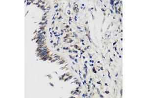 Immunohistochemistry (IHC) image for anti-SET and MYND Domain Containing 1 (SMYD1) (AA 1-350) antibody (ABIN6148163)