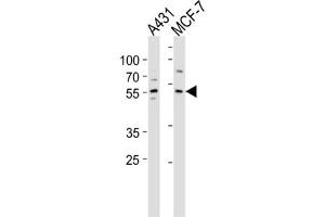 Western Blotting (WB) image for anti-Kruppel-Like Factor 4 (Gut) (KLF4) antibody (ABIN2996460) (KLF4 antibody)