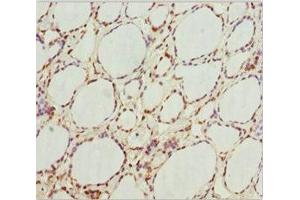Immunohistochemistry of paraffin-embedded human thyroid tissue using ABIN7154750 at dilution of 1:100 (GNB1L antibody  (AA 1-327))