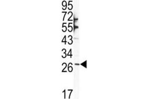 Western blot analysis of SNAI1 antibody and NCI-H460 lysate (SNAIL antibody  (AA 1-30))