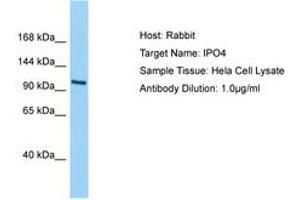 Image no. 1 for anti-Importin 4 (IPO4) (AA 468-517) antibody (ABIN6750201) (Importin 4 antibody  (AA 468-517))