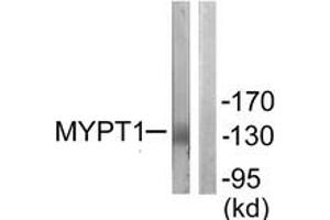 Western blot analysis of extracts from NIH-3T3 cells, using MYPT1 (Ab-853) Antibody.