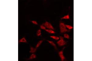 ABIN6274897 staining Hela cells by IF/ICC. (EPB41L2 antibody  (Internal Region))