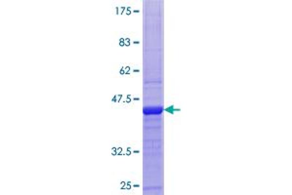 CST2 Protein (AA 1-141) (GST tag)