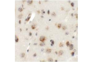Immunohistochemistry of AP3B2 in mouse brain tissue with AP3B2 antibody at 5 μg/mL. (AP3B2 antibody  (N-Term))
