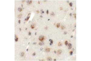 Immunohistochemistry of AP3B2 in mouse brain tissue with AP3B2 antibody at 5 μg/mL.