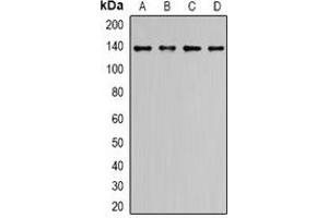 Western blot analysis of ALPK1 expression in LO2 (A), HCT116 (B), COLO205 (C), HepG2 (D) whole cell lysates.