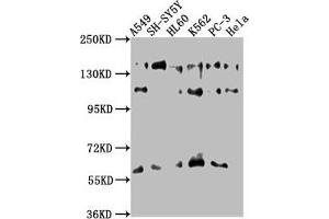 Western Blot Positive WB detected in: A549 whole cell lysate, SH-SY5Y whole cell lysate, HL60 whole cell lysate, K562 whole cell lysate, PC-3 whole cell lysate, Hela whole cell lysate All lanes: SOS2 antibody at 1:1000 Secondary Goat polyclonal to rabbit IgG at 1/50000 dilution Predicted band size: 153, 150 kDa Observed band size: 153 kDa (SOS2 antibody  (AA 187-404))