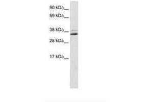 Image no. 1 for anti-Secreted Frizzled-Related Protein 1 (SFRP1) (C-Term) antibody (ABIN202220) (SFRP1 antibody  (C-Term))
