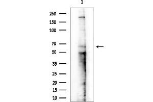 Western blot analysis of lysates from EC304 cells(heat-shock treatment), using Phospho-Estrogen Receptor alpha (Ser167) Antibody at 1/1000 dilution.