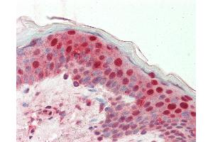 Anti-E4F1 / E4F antibody IHC staining of human skin.