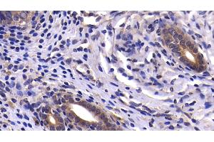 Detection of CASP9 in Rat Uterus Tissue using Polyclonal Antibody to Caspase 9 (CASP9) (Caspase 9 antibody  (AA 1-200))