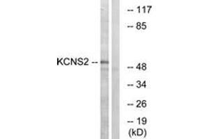 Western blot analysis of extracts from HepG2 cells, using KCNS2 Antibody. (KCNS2 antibody  (AA 197-246))