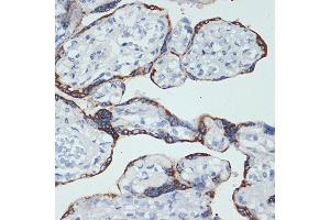 Immunohistochemistry of paraffin-embedded human placenta using HSD3B1 Rabbit mAb (ABIN7267801) at dilution of 1:100 (40x lens). (HSD3B1 antibody)
