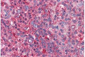 Human Spleen: Formalin-Fixed, Paraffin-Embedded (FFPE) (BIRC3 antibody  (AA 314-508))