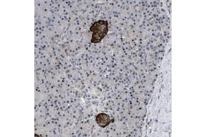Immunohistochemical staining of human pancreas with ZDHHC15 polyclonal antibody  shows strong cytoplasmic positivity in islet cells. (ZDHHC15 antibody)