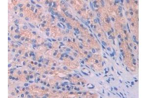 Immunohistochemistry (IHC) image for anti-Lysosomal-Associated Membrane Protein 2 (LAMP2) (AA 191-362) antibody (ABIN7437248)