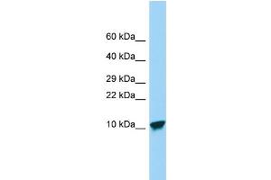 Host: Rabbit Target Name: SPINK9 Sample Type: Placenta lysates Antibody Dilution: 1. (SPINK9 antibody  (Middle Region))