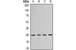 Western blot analysis of RAB11A expression in Jurkat (A), SHSY5Y (B), PC12 (C), mouse spleen (D) whole cell lysates.