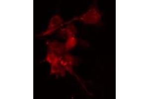 ABIN6274202 staining Hela cells by IF/ICC. (PRKACB antibody  (C-Term))
