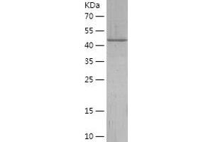 Western Blotting (WB) image for Fetuin B (FETUB) (AA 177-382) protein (His-IF2DI Tag) (ABIN7284017) (FETUB Protein (AA 177-382) (His-IF2DI Tag))