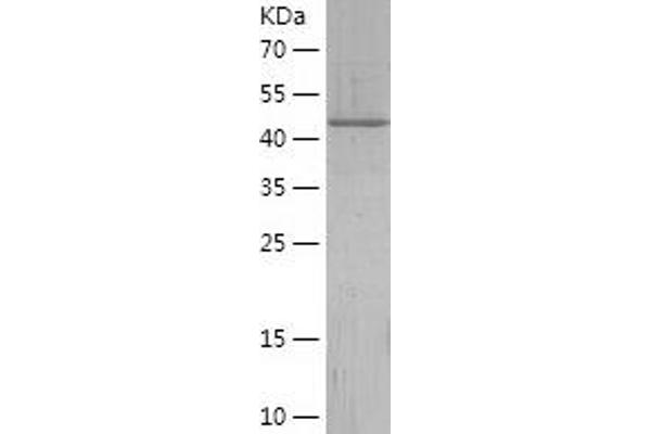 FETUB Protein (AA 177-382) (His-IF2DI Tag)